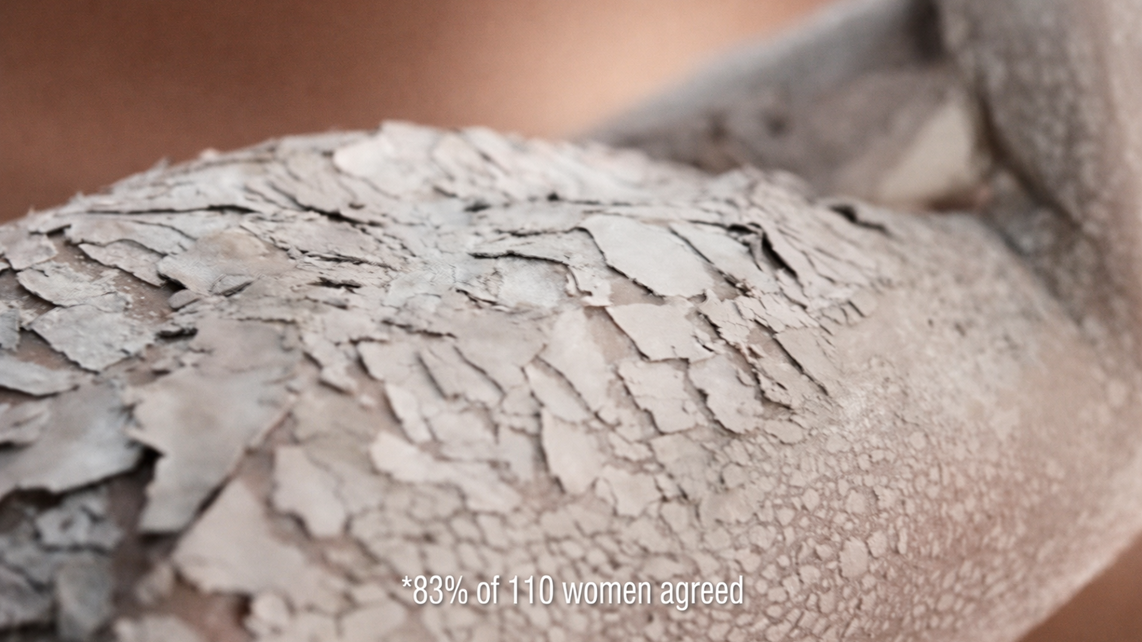 An image from the video wherein the black woman was shown initially then changed its appearance with flaky and dry skin